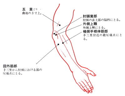 SSPテニス肘治療ポイント
